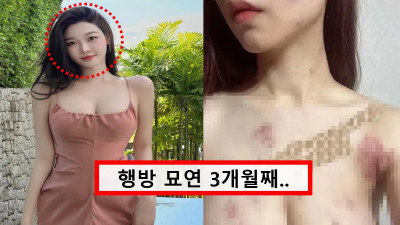 알몸 상태로 구타당해... 수백만 팔로워 유명 인플루언서 알몸 구타 영상 확산에 모두 충격받았다