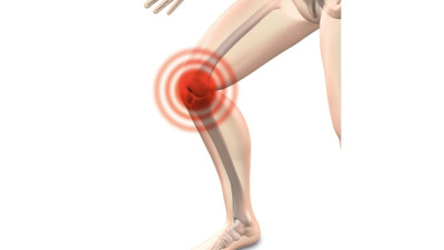 관절이 욱신 거리면? 염증과 통증 줄여주는 3가지 식품