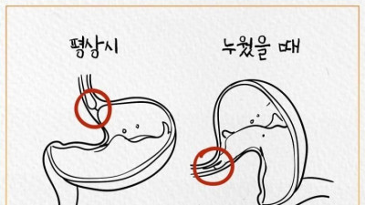 식사후 눕는게 엄청 위험한 이유