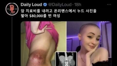   				암에 걸린 남자와 여자의 차이			