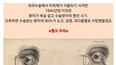 (혐주의) 오싹오싹 근현대의 외과수술