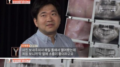 치과의사들도 충격 받은 진료사진