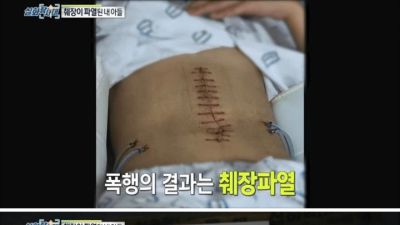 학교 폭력으로 췌장이 절단된 사건