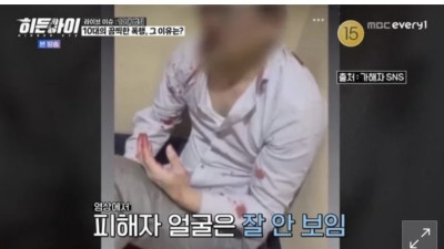 12살 초등생에게 피떡 되도록 맞은 40대 스윗남