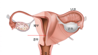 자궁까지 삽입이 안 되는 이유...jpg