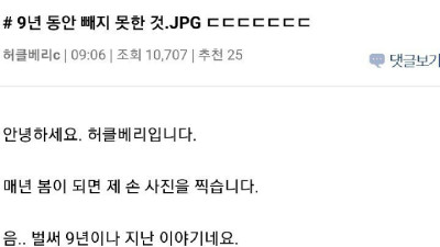 한 남자가 9년동안 손가락에서 빼지 못한 것